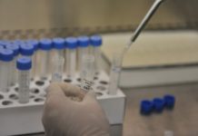 Во Скопје во приватна лабораторија детектиран британскиот сој на коронавирусот