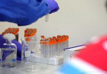 МЗ: Потврдени се 1.913 нови случаи на Ковид-19, починаа 16 лица