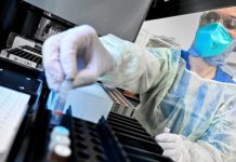 МЗ: Невакцинирани 77 отсто од заразените, 79 отсто од хоспитализираните и 85 отсто од починатите