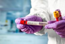 МЗ: Последните 3 дена потврдени се 81 нови случаи на Ковид-19